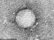 Nueva línea para Tratar Hepatitis Embarazadas