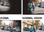 Tratamientos glaucoma ceguera