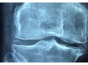 Lubricina determina Lesiones Articulares