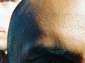 denuncia «engaño» mayoría tratamientos contra caída cabello