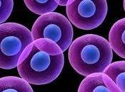 Esclerosis múltiple células madre