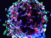 caras plasticidad celular: Stem Cells desarrollo cáncer