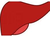 Factores desencadenantes cirrosis hepática severa