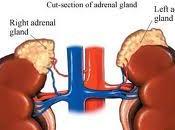 Enfermedad Addison