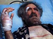 Caricaturista sirio Ferzat agredido régimen fracturaron manos