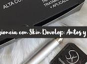 experiencia tratamiento SKIN DEVELOP: Antes después