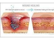 Nuevo medicamento cura Heridas dejar Cicatrices