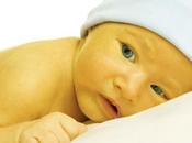 Ictericia neonatal ¿Qué cómo trata?