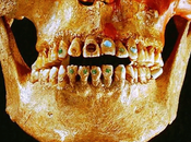 Breve repaso historia Odontología Clínica Dental Urbina Salamanca