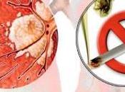 vacuna cubana contra cáncer podría servirme futuro