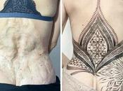Personas pidieron tatuadores cubrieran cicatrices marcas nacimiento pudieron estar contentos resultado