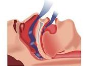 Infecciones tracto respiratorio inferior asociadas apnea obstructiva