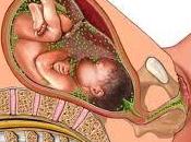 Prevención Infección Perinatal