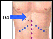 Respuesta 'Madre sospecha negligencia médica' (11)