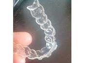 Ataches Invisalign ¿Qué son? ¿Para sirven? ven?