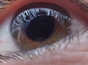 Cinco pruebas comunes para glaucoma.