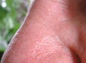 Alzheimer perdida olfato