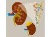 lesión renal COVID común esperado