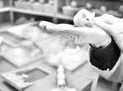 Alzheimer, ¿Exceso vasos sanguíneos?