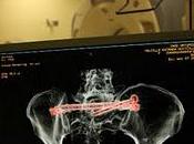 Innovación experiencia, binomio indisoluble UMAE traumatología ortopedia años creación