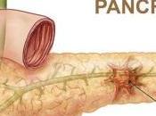 futuro cáncer pancreático