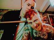 FRANK CARTER RATTLESNAKES Parasite