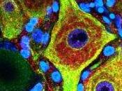 Muerte celular programada