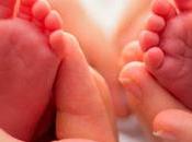 extraña condición “gemelo parásito” extraído cerebro niña