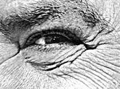 Historias UVI: Sepsis