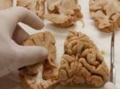 banco Salamanca reúne seis donaciones cerebro para investigación