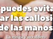 Puedes Evitar Eliminar Callosidades Manos