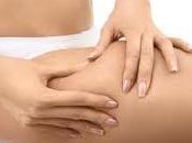 Tratamientos comunes para celulitis