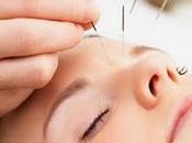 Hallan acupuntura segura para niños
