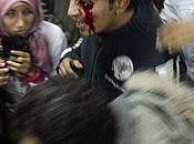 Tirador experto policía egipcia saca ojos cinco manifestantes balas goma