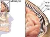 Causas tratamiento meningitis