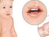 señor! acertaron, trataba enfermedad mano-boca-pie