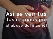 órganos abuso alcohol