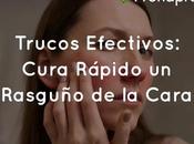 Trucos Efectivos: Cura Rápido Rasguño Cara