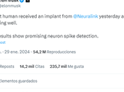 Neuralink: chips cerebrales Elon Musk desafían futuro