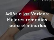 Adiós Varices: Mejores remedios para eliminarlas