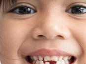 ¿Por pierden dientes niños? Aprende todo sobre pérdida niños