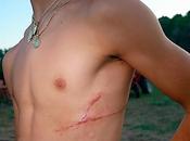 falsos mitos cuidado cicatrices