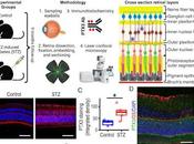 Encuentran factor desencadenante Retinopatía Diabetica