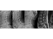 microbioma intestinal afecta salud columna vertebral?