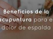 Beneficios acupuntura para dolor espalda