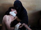 "Piedad Árabe", ganadora World Press Photo