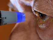 ¿Qué presión intraocular?