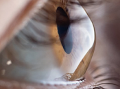 terapia células madre parece prometedora para lesiones corneales.