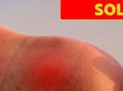 Alivio rápido para quemaduras remedios naturales