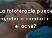 fototerapia puede ayudar combatir acné?